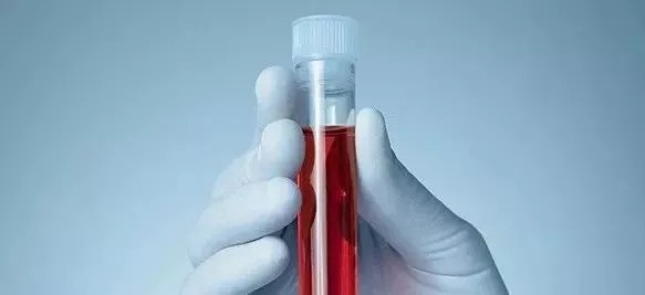 液體活檢新方向?NIPT技術(shù)奠基人Stephen Quake新作上線