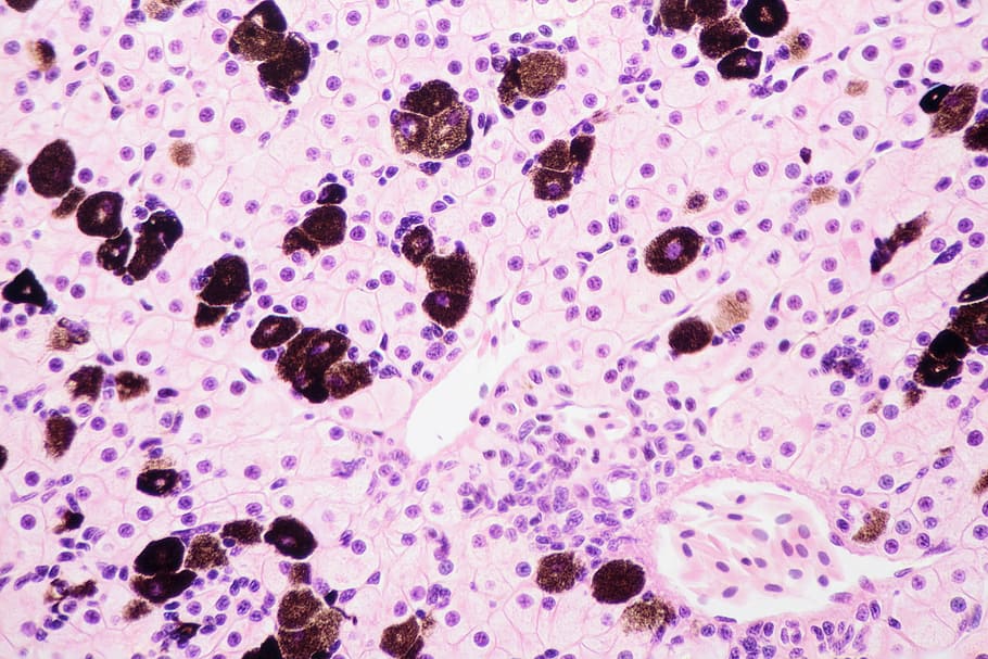 ѪеĜy˜ 늸ϵxw|VlИI˜ʰl